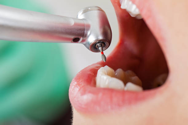 Best Emergency Treatment for Dental Infections or Abscesses in Hartford, KY